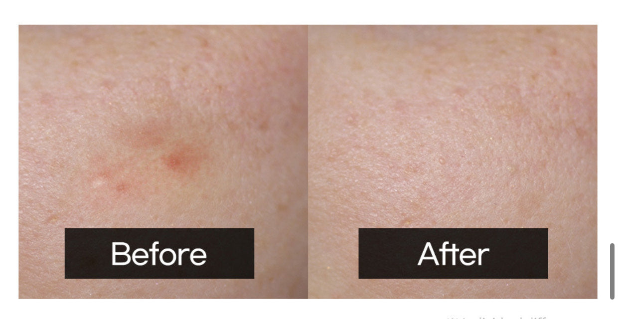 Design Your Beauty Apple Hip Patch